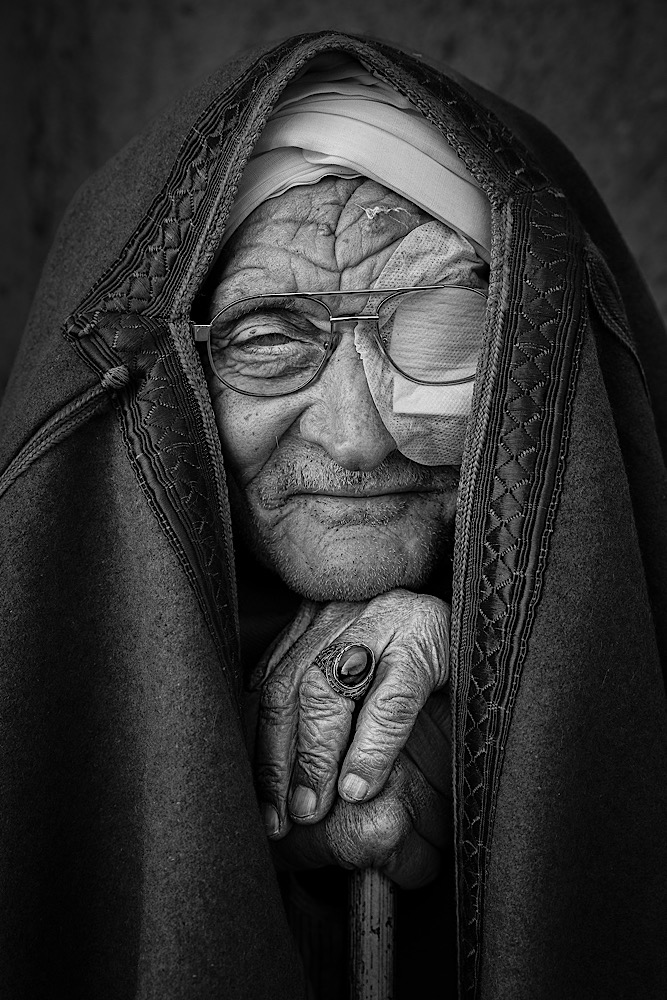 A scarred gaze